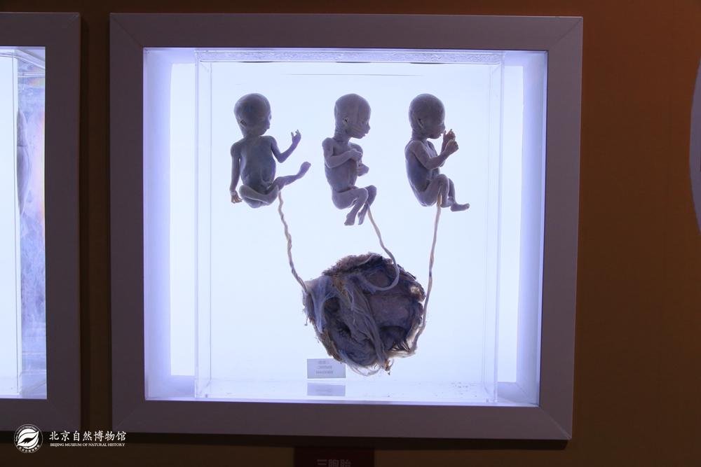 18�ܵ�������