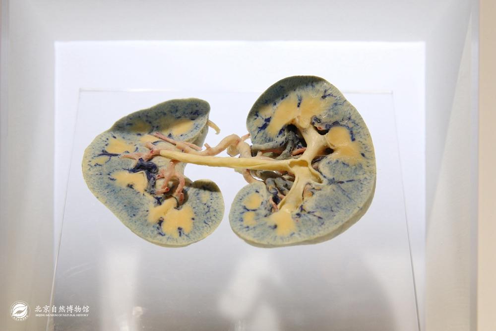 ����״�У�Ѫ�ܹ�ע��